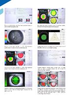 CORNEAL TOPOGRAPHY CT-800