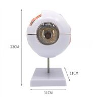 Anatomical eye model, dismountable, with thin blood vessels, scale 6:1