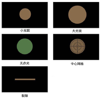 Офтальмоскоп YZ11D + ретиноскоп щелевой YZ24B в дном наборе